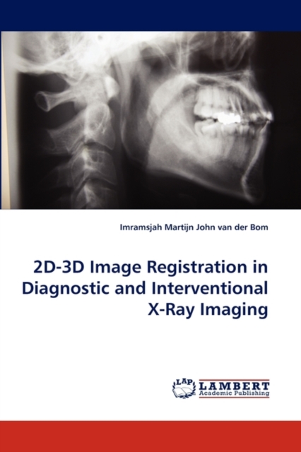 2D-3D Image Registration in Diagnostic and Interventional X-Ray Imaging, Paperback / softback Book