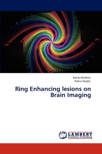 Ring Enhancing Lesions on Brain Imaging, Paperback / softback Book