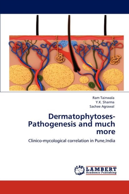 Dermatophytoses-Pathogenesis and Much More, Paperback / softback Book