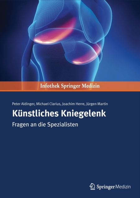 Kunstliches Kniegelenk : Fragen an die Spezialisten, Paperback Book