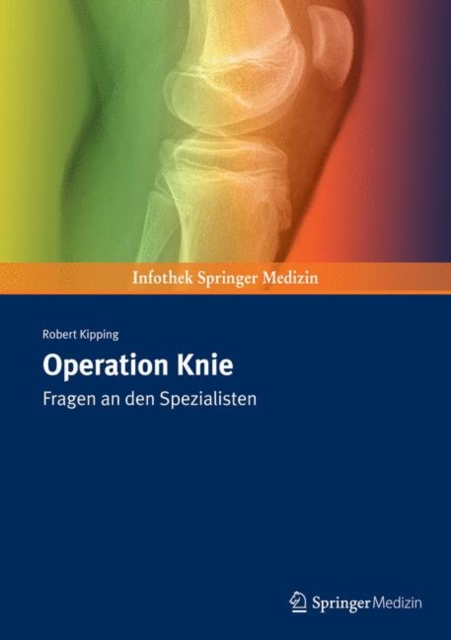 Operation Knie : Fragen an den Spezialisten, Paperback Book