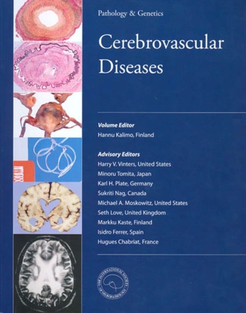 Cerebrovascular Diseases, Paperback / softback Book