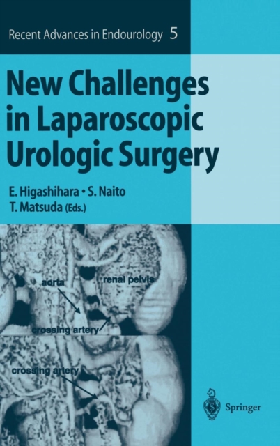 New Challenges in Laparoscopic Urologic Surgery, Hardback Book