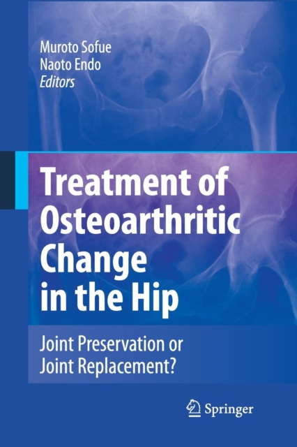 Treatment of Osteoarthritic Change in the Hip : Joint Preservation or Joint Replacement?, Paperback / softback Book