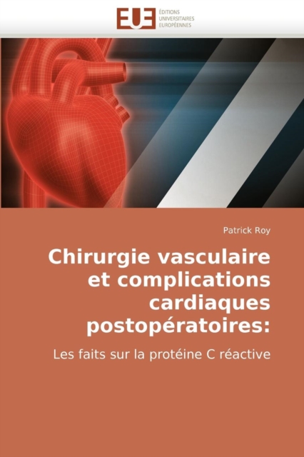 Chirurgie Vasculaire Et Complications Cardiaques Postop ratoires, Paperback / softback Book