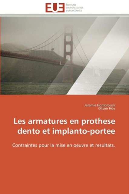 Les Armatures En Prothese Dento Et Implanto-Portee, Paperback / softback Book