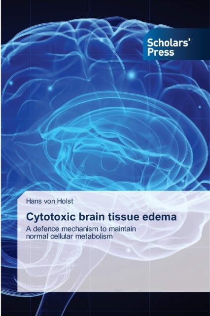 Cytotoxic brain tissue edema, Paperback / softback Book