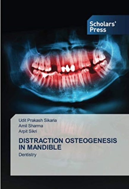 Distraction Osteogenesis in Mandible, Paperback / softback Book