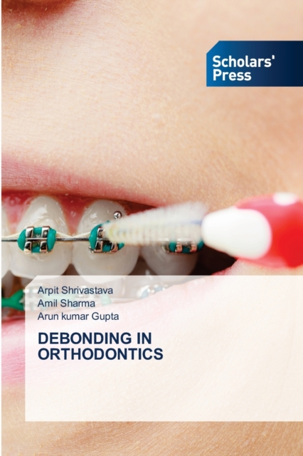 Debonding in Orthodontics, Paperback / softback Book