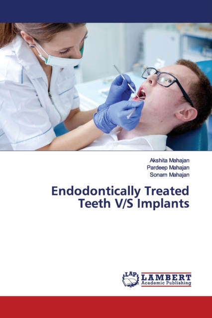 Endodontically Treated Teeth V/S Implants, Paperback / softback Book