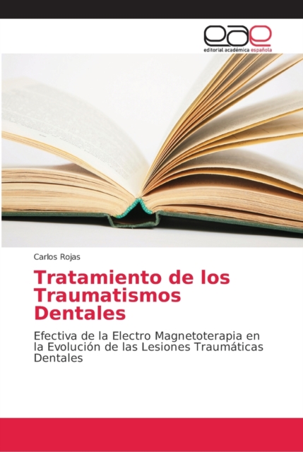 Tratamiento de los Traumatismos Dentales, Paperback / softback Book