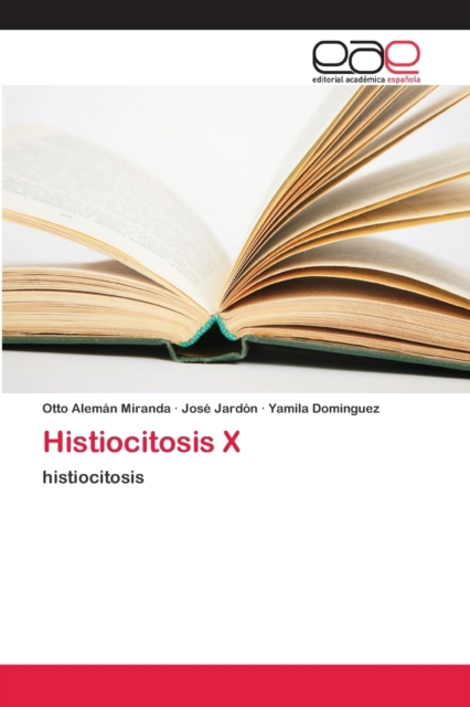 Histiocitosis X, Paperback / softback Book
