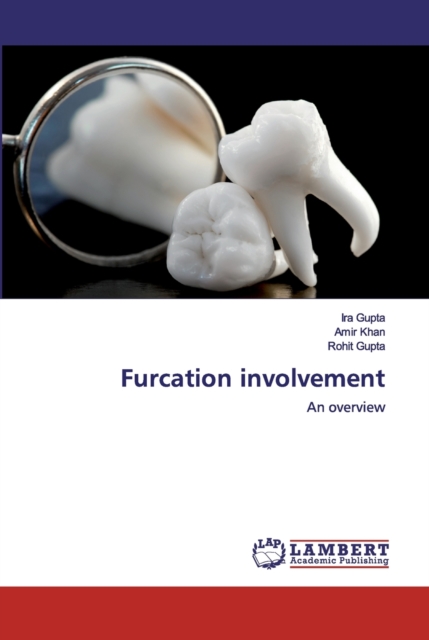 Furcation involvement, Paperback / softback Book
