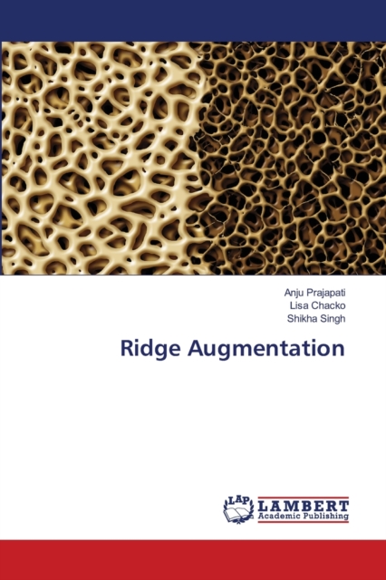 Ridge Augmentation, Paperback / softback Book
