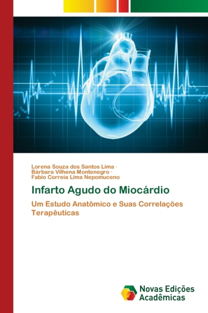 Infarto Agudo do Miocardio, Paperback / softback Book
