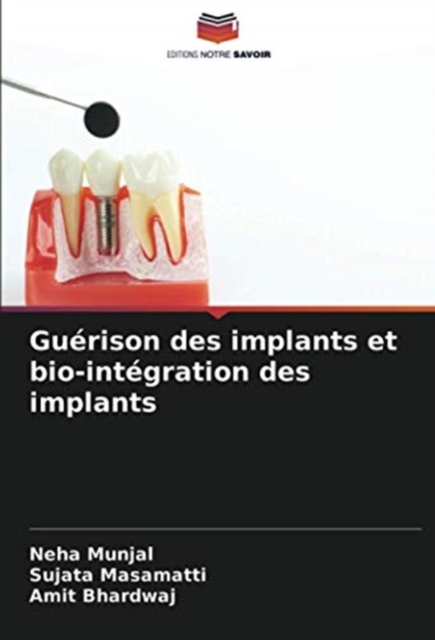 Guerison des implants et bio-integration des implants, Paperback / softback Book