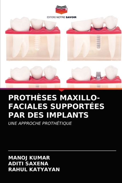 Protheses Maxillo-Faciales Supportees Par Des Implants, Paperback / softback Book