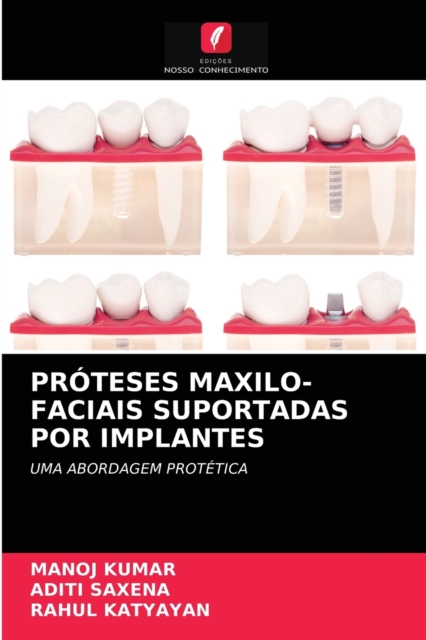 Proteses Maxilo-Faciais Suportadas Por Implantes, Paperback / softback Book