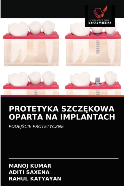 Protetyka Szcz&#280;kowa Oparta Na Implantach, Paperback / softback Book