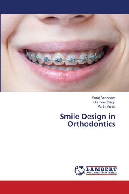 Smile Design in Orthodontics, Paperback / softback Book