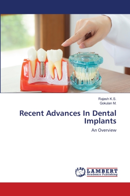 Recent Advances In Dental Implants, Paperback / softback Book