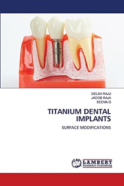 Titanium Dental Implants, Paperback / softback Book