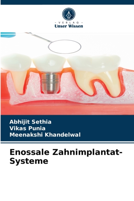 Enossale Zahnimplantat-Systeme, Paperback / softback Book