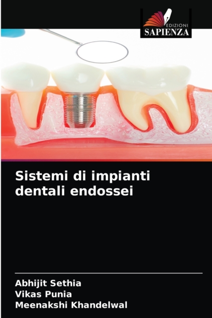 Sistemi di impianti dentali endossei, Paperback / softback Book