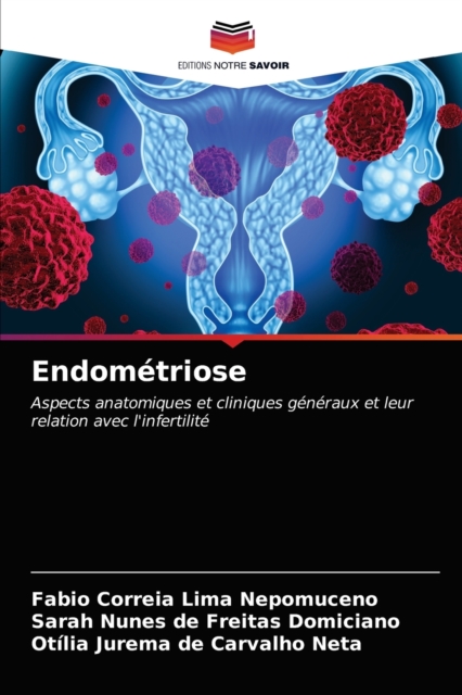 Endometriose, Paperback / softback Book