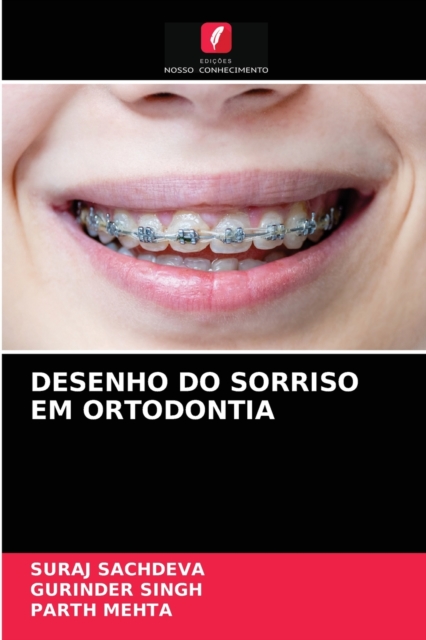 Desenho Do Sorriso Em Ortodontia, Paperback / softback Book