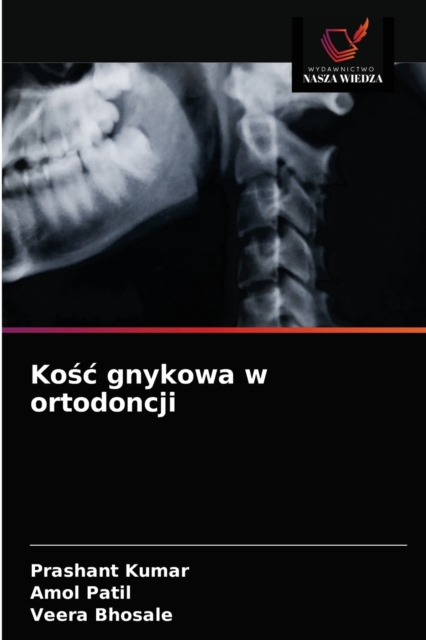 Ko&#347;c gnykowa w ortodoncji, Paperback / softback Book