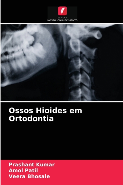 Ossos Hioides em Ortodontia, Paperback / softback Book