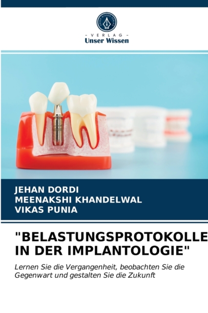 "Belastungsprotokolle in Der Implantologie", Paperback / softback Book