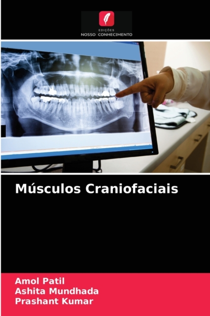 Musculos Craniofaciais, Paperback / softback Book