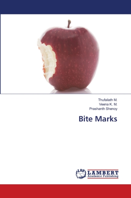 Bite Marks, Paperback / softback Book