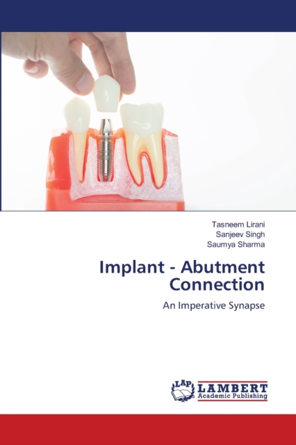Implant - Abutment Connection, Paperback / softback Book