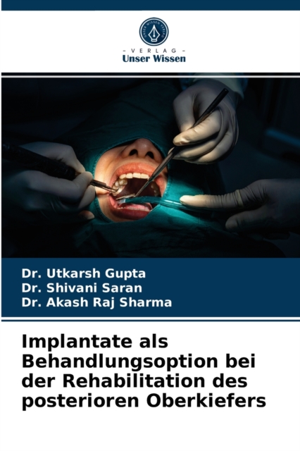 Implantate als Behandlungsoption bei der Rehabilitation des posterioren Oberkiefers, Paperback / softback Book