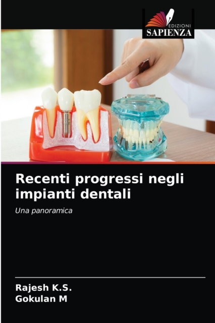 Recenti progressi negli impianti dentali, Paperback / softback Book