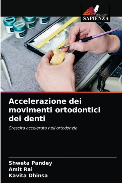 Accelerazione dei movimenti ortodontici dei denti, Paperback / softback Book