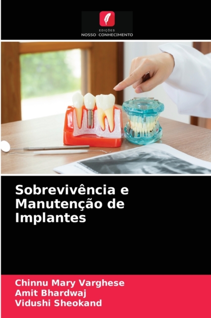 Sobrevivencia e Manutencao de Implantes, Paperback / softback Book