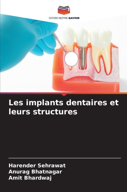 Les implants dentaires et leurs structures, Paperback / softback Book