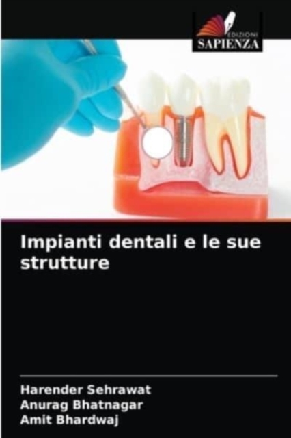 Impianti dentali e le sue strutture, Paperback / softback Book