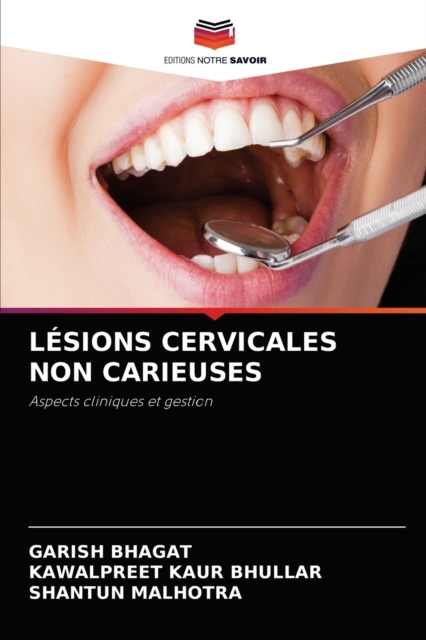 Lesions Cervicales Non Carieuses, Paperback / softback Book