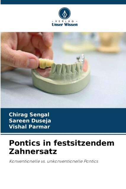 Pontics in festsitzendem Zahnersatz, Paperback / softback Book