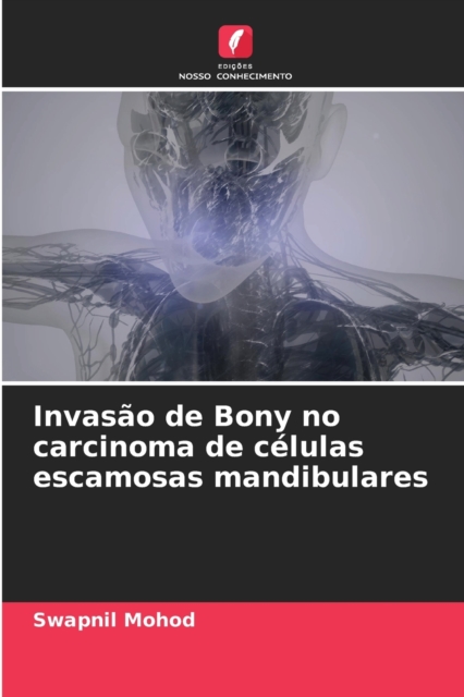Invasao de Bony no carcinoma de celulas escamosas mandibulares, Paperback / softback Book