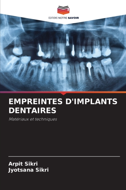 Empreintes d'Implants Dentaires, Paperback / softback Book