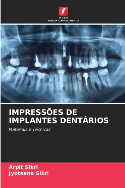 Impressoes de Implantes Dentarios, Paperback / softback Book