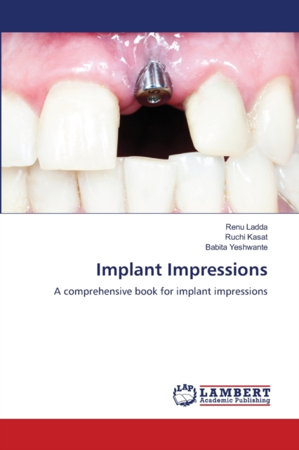 Implant Impressions, Paperback / softback Book