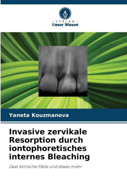 Invasive zervikale Resorption durch iontophoretisches internes Bleaching, Paperback / softback Book
