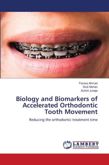 Biology and Biomarkers of Accelerated Orthodontic Tooth Movement, Paperback / softback Book
